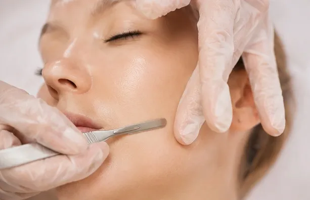 Dermaplaning